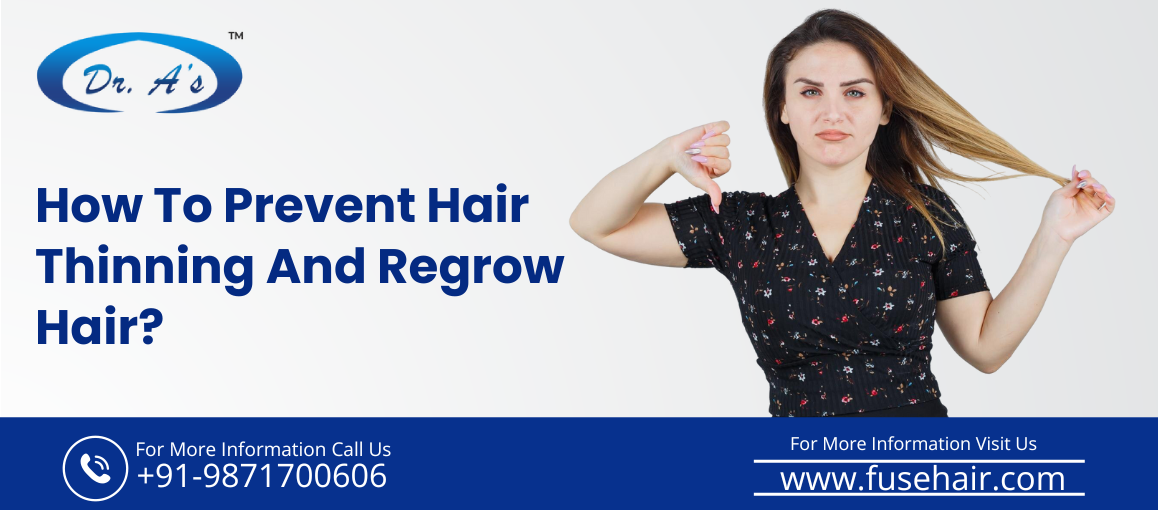 hair loss treatment in Delhi