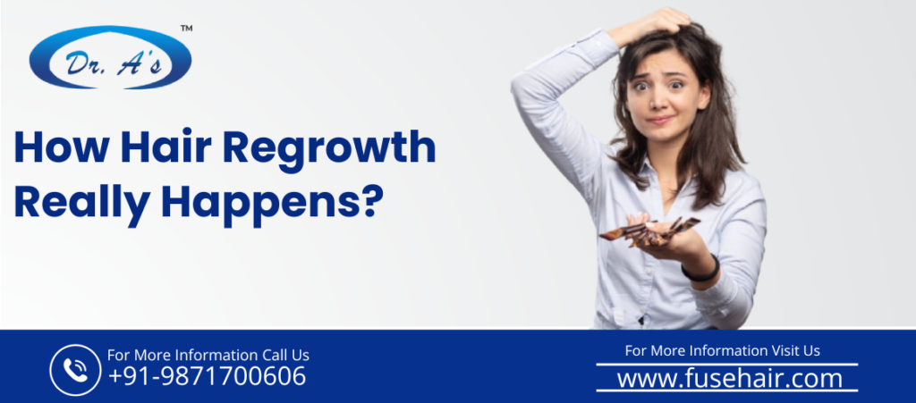 hair regrowth treatment in Delhi