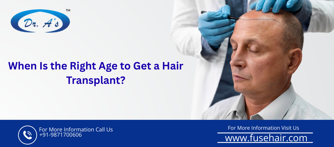 hair transplant age