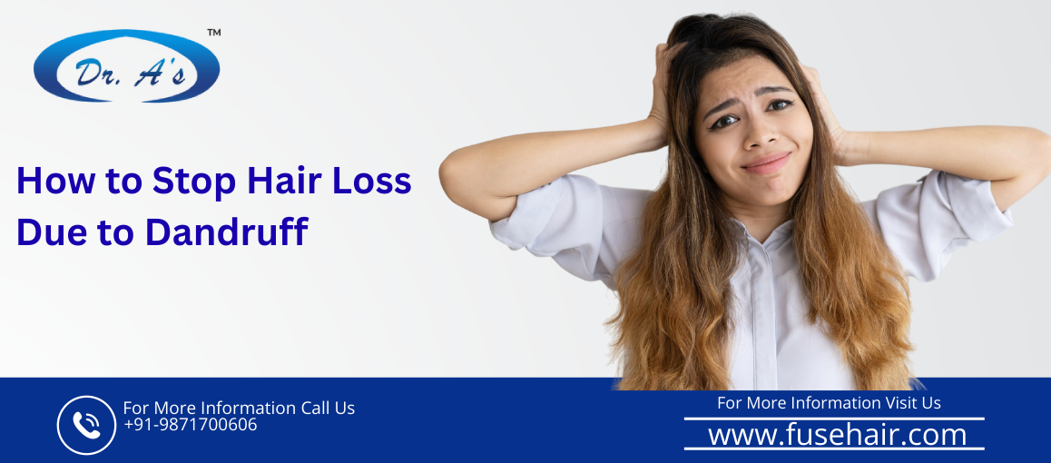 hair loss due to dandruff