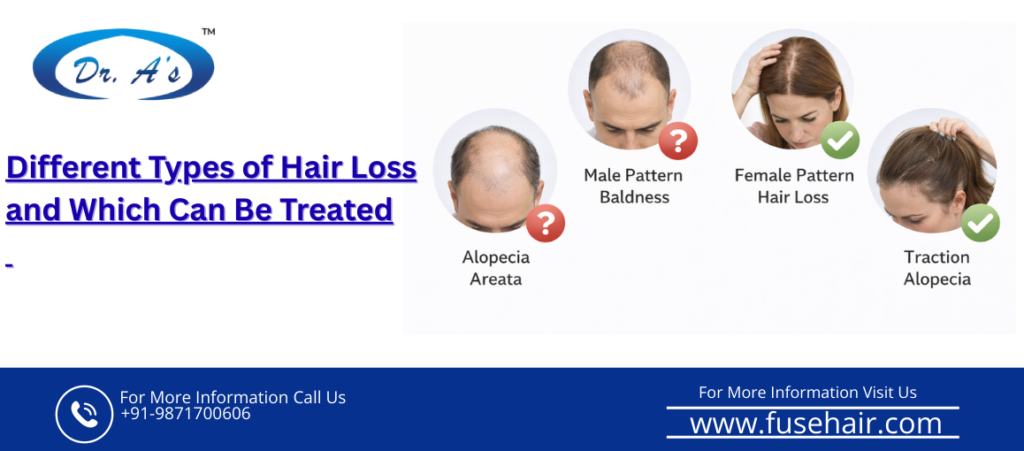 hair loss stages