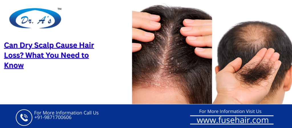 dry scalp hair loss