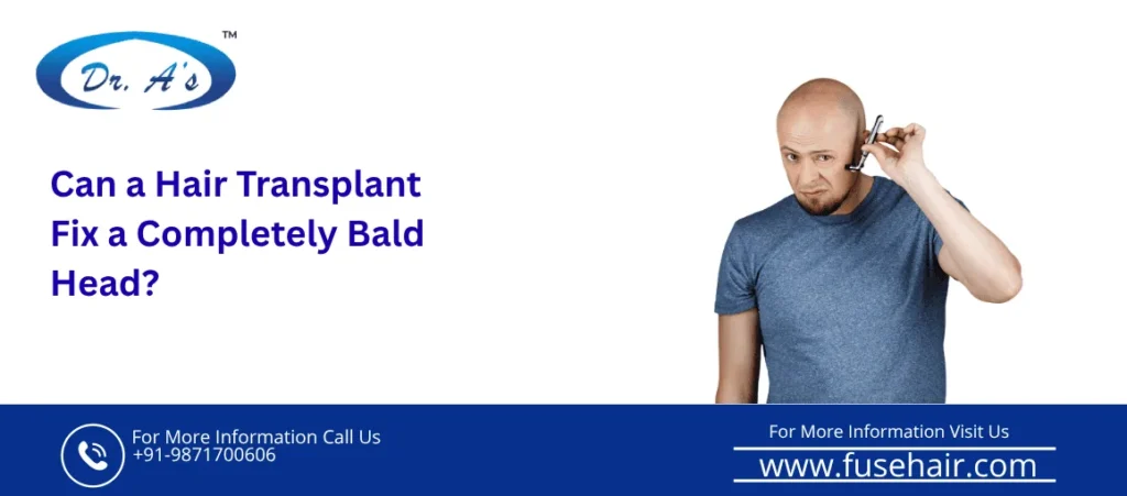 Can a Hair Transplant Fix a Completely Bald Head?