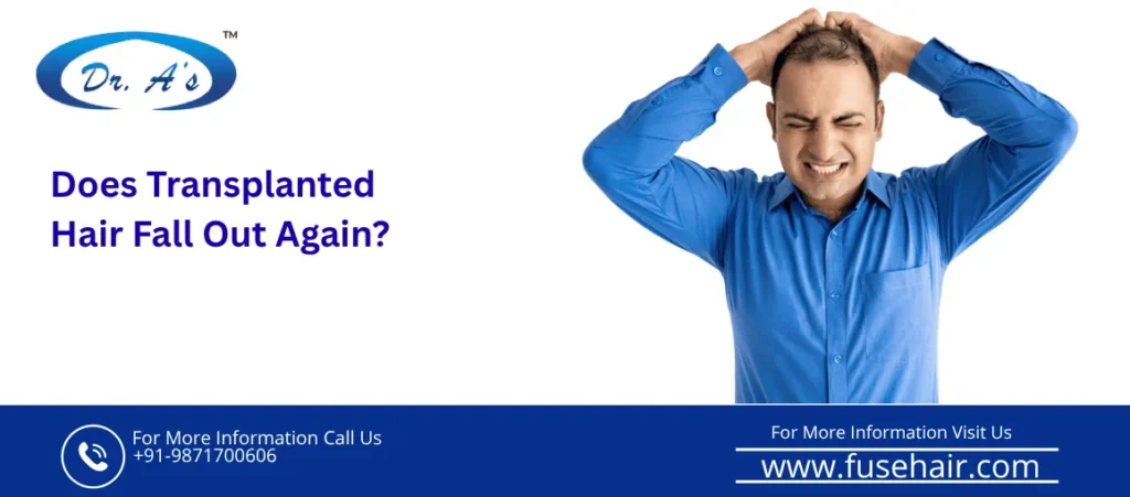 Does Transplanted Hair Fall Out Again?