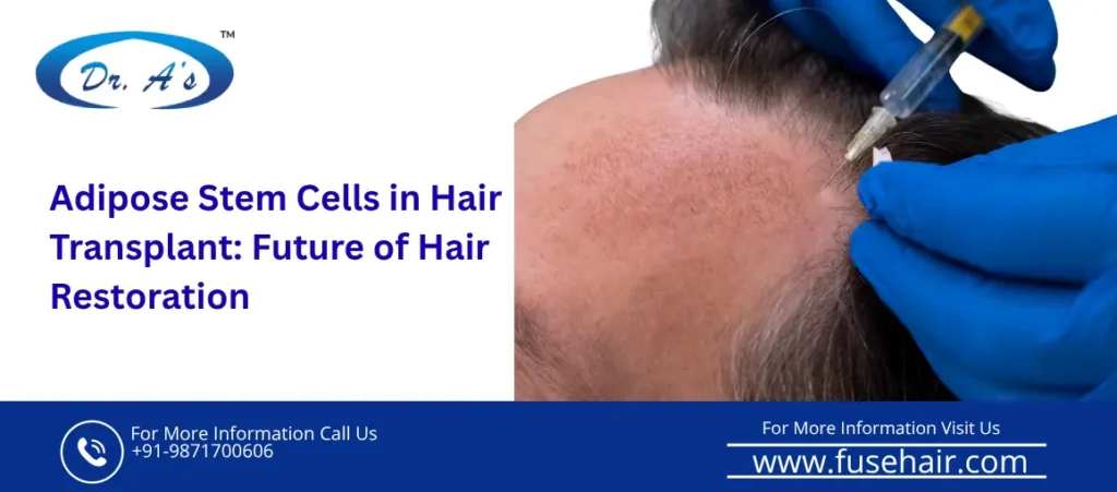 Adipose stem cell in hair transplant