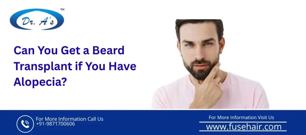 beard alopecia
