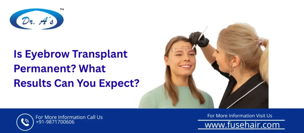 Best hair transplant clinic in Delhi