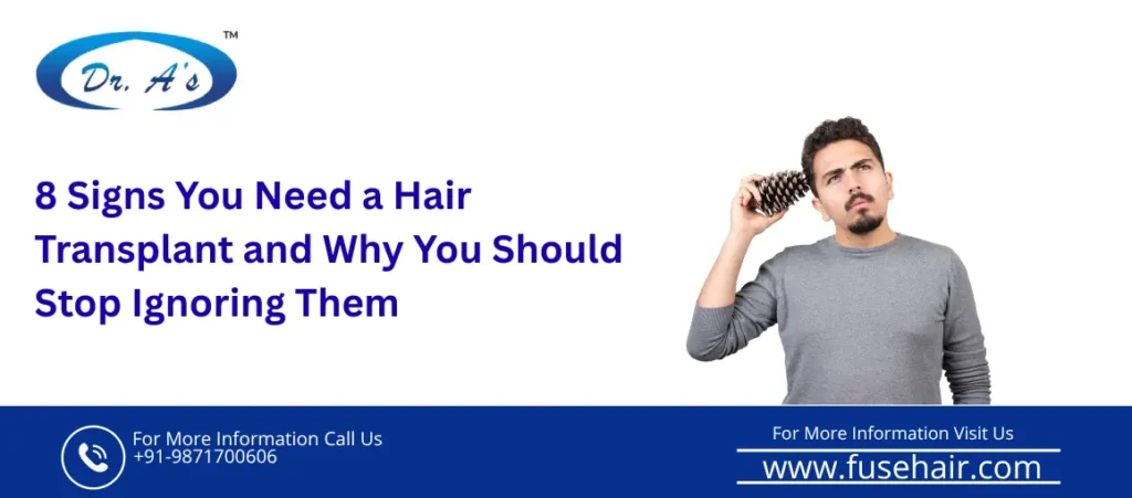 Signs You Need a Hair Transplant