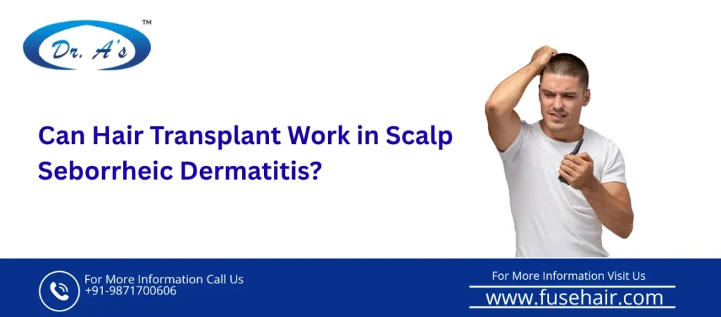 Hair transplant seborrheic dermatitis