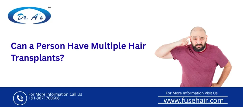 Multiple hair transplants