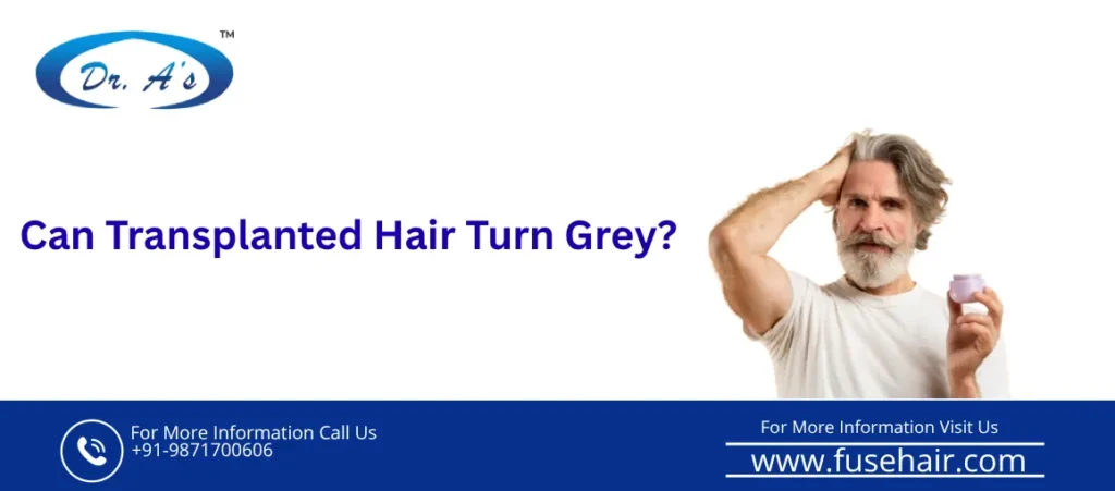 transplanted hair turn grey