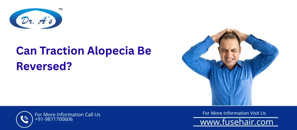 Traction Alopecia
