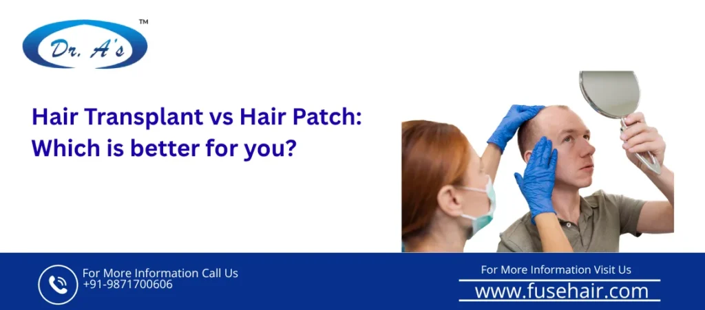 Hair Transplant vs Hair Patch