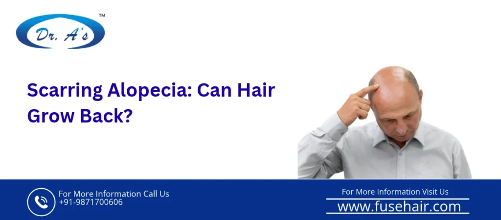 Scarring Alopecia