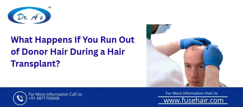 limited donor hair for hair transplant