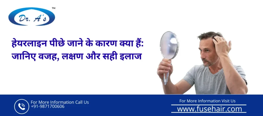 हेयरलाइन पीछे जाने के कारण