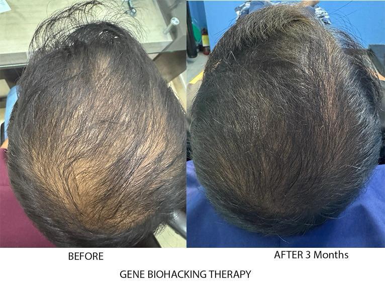 Gene Biohacking Therapy
