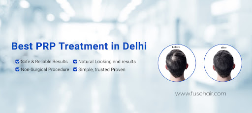 best prp treatment in delhi gurgaon