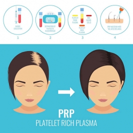 Prp Treatment