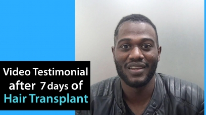 Afro Hair Transplant Video Testimonial