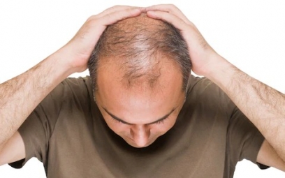 male hair loss treatment in delhi