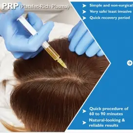 PRP Treatment