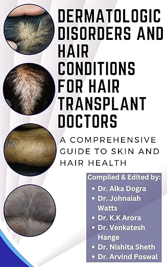 dermatologic-disorders-conditions-transplant-doctors