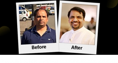 Celebrities Hair Transplant in Delhi