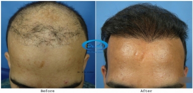Sub Gallery Hair repair