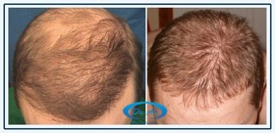 A comparison picture 2
