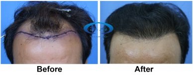 A comparison picture 2