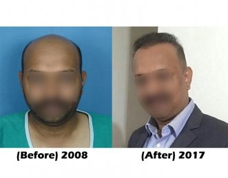 A comparison picture