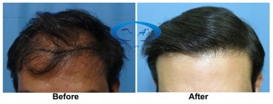 A comparison picture
