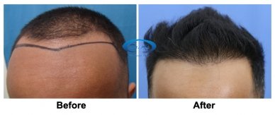 A comparison picture