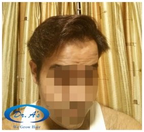After 9 months picture 1