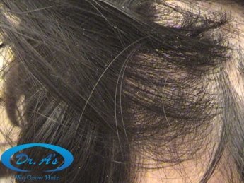 After picture - 6