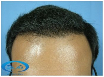 After picture with different hair style