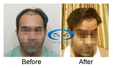 Comparison picture 1