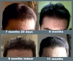Photo Chart 4