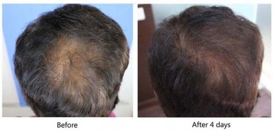 Comparison picture 1